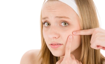 Novas tendências no tratamento da acne