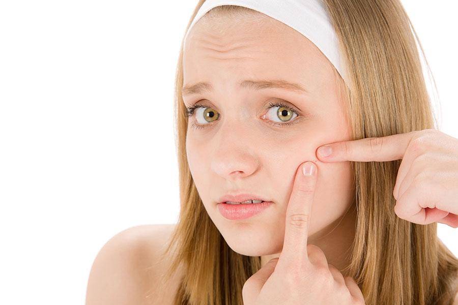Novas tendências no tratamento da acne